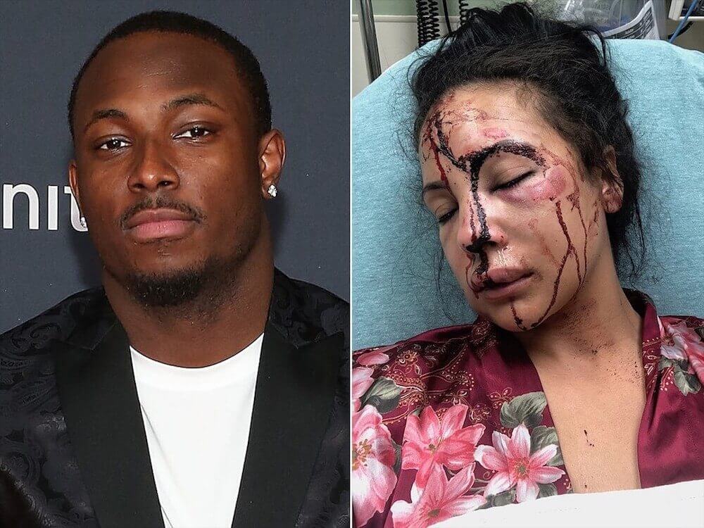 Black NFL Star Accused of Brutal Assault of Ex-Girlfriend During Home Invasion-2